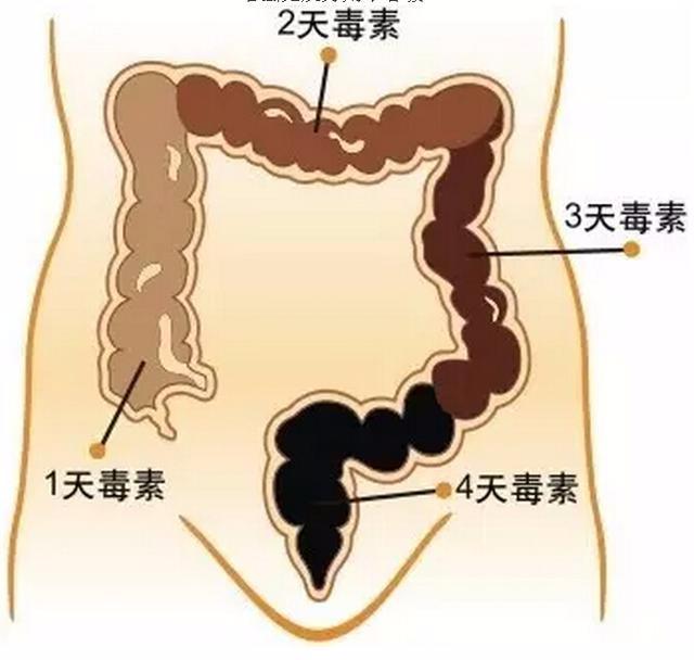 終究找到腸炎（癌）的禍端了。醫師提示：6個壞習慣，早改早健康 健康 第1張