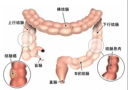 欲長命，則先「腸」壽，保持7件事保護腸道健康 健康 第1張