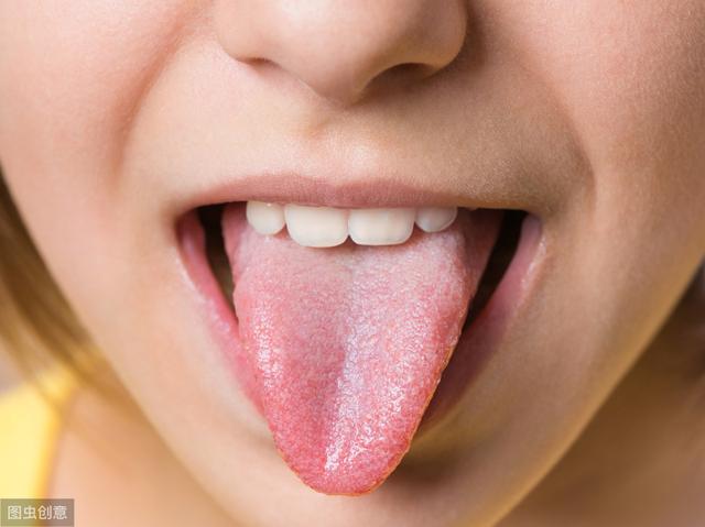舌頭出現這三種變化，要警惕健康~ 顏色深淺，代表什麼意義？ 未分類 第1張