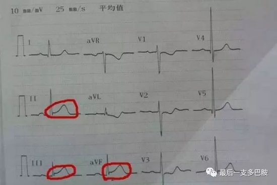 快看那個死活都要輸液的病人最後都變成什麼樣了！醫生：現在想起來都後怕！ 健康 第1張