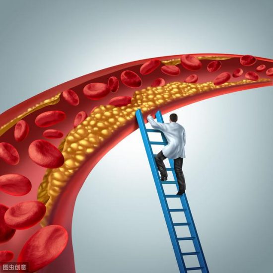 如何控制好動脈硬化斑塊，減少血栓風險，醫生一次性為你說清 健康 第1張