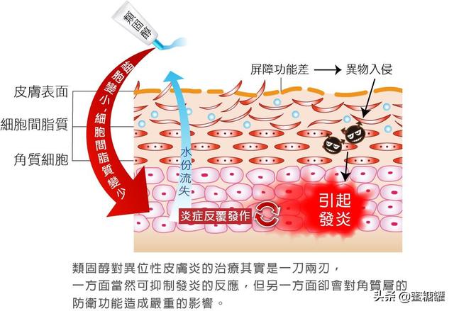 異位性皮膚炎治療/做對四件事，寶寶的異位性皮膚炎（濕疹）不再來 汪醫師產文 第2張