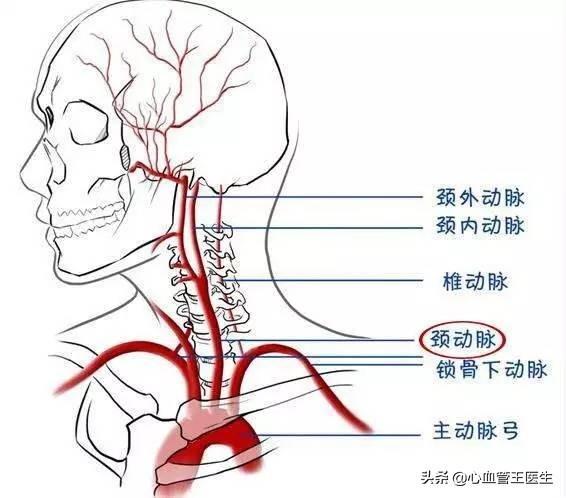 改善心血管疾病/為什麼頸動脈更容易發生斑塊和狹窄，導致腦梗死？醫生這次講明白 汪醫師產文 第4張