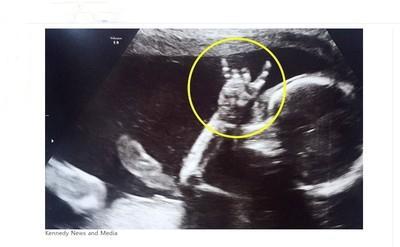 父母胎教為女兒播放經典歌曲 女嬰在媽媽肚子裡比出Rock手勢 親子 第1張