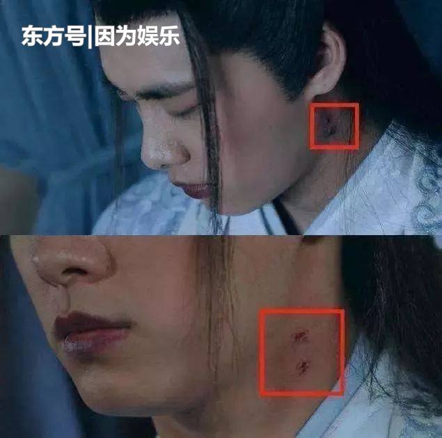 李易峰太搞笑了吧，他脖子上的傷痕實在是戲多，搞得觀眾困惑不解 娛樂 第2張