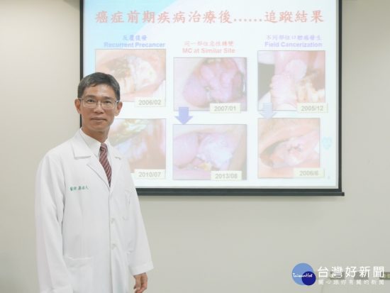 檳榔子屬一級致癌物　嚼食檳榔得口腔癌機率達11倍 台灣好新聞 第1張