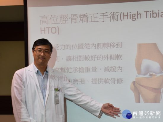 退化性膝關節炎治療新選擇　雙側固定高位脛骨截骨手術 台灣好新聞 第1張