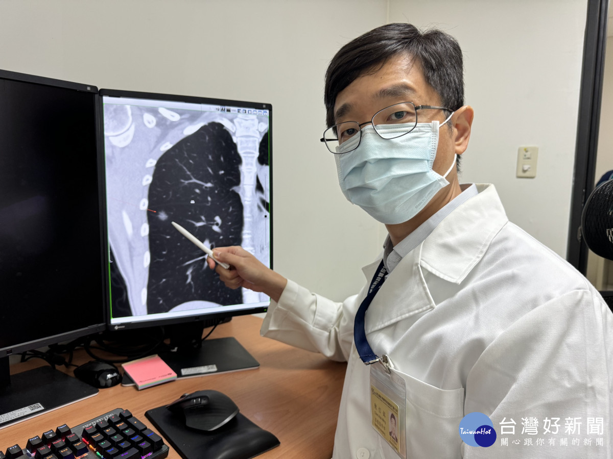肺癌無聲無息　醫師建議及早篩檢 台灣好新聞 第1張