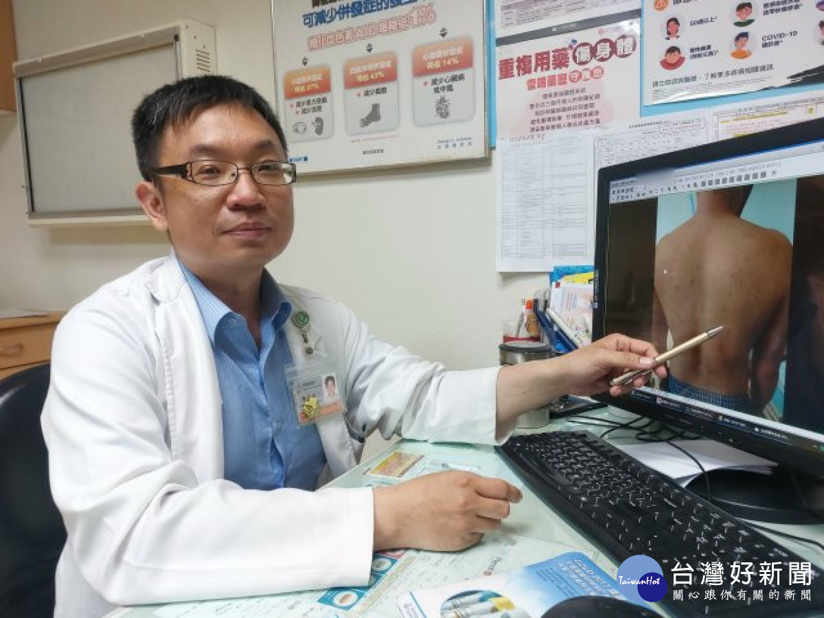 不只登革熱與新冠！水痘案例狂增　醫籲未感染者盡速接種疫苗 台灣好新聞 第1張