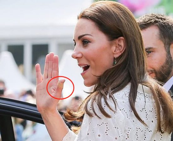 凱特王妃手指上的OK繃藏著秘密， 原因讓所有人“猜破頭”-尋夢新聞