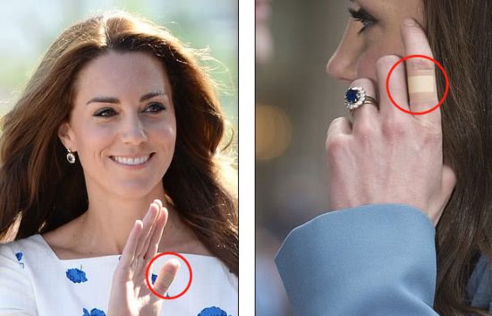 凱特王妃手指上的OK繃藏著秘密， 原因讓所有人“猜破頭”-尋夢新聞
