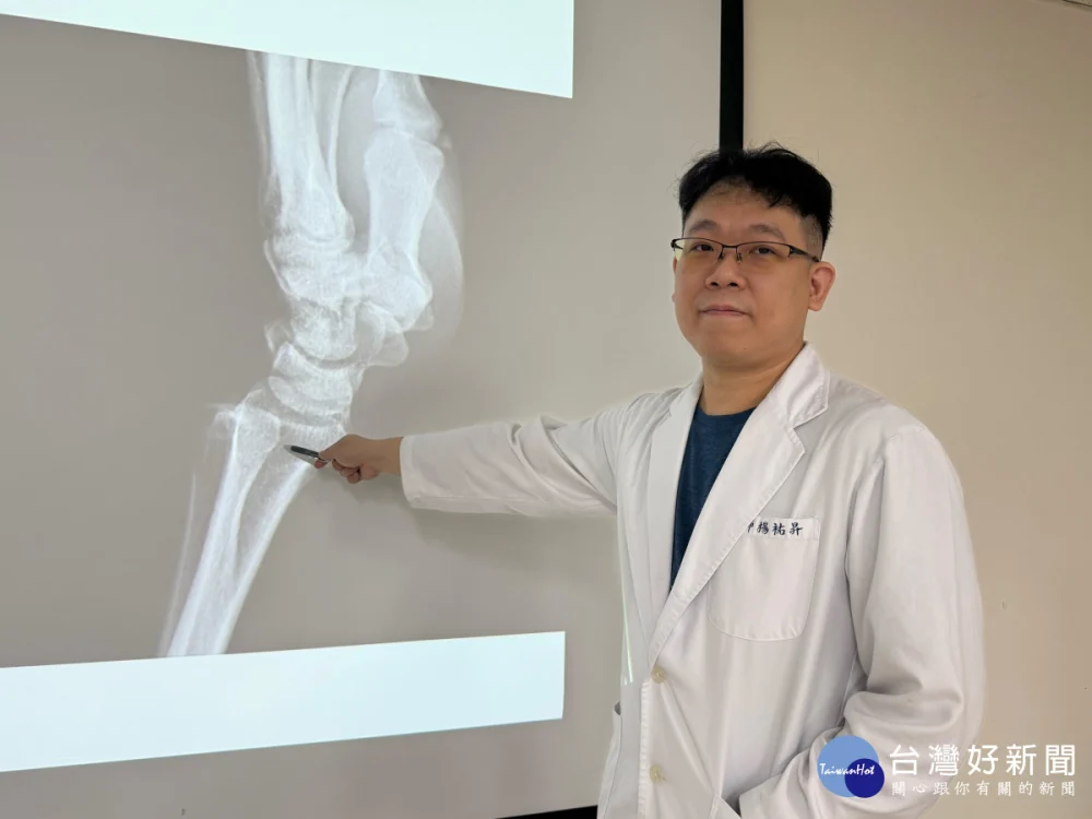 台中醫院楊祐昇醫師