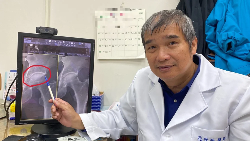 裝潢師傅蹲了一輩子卻再也蹲不下去   醫師診斷為髖關節夾擠症候群