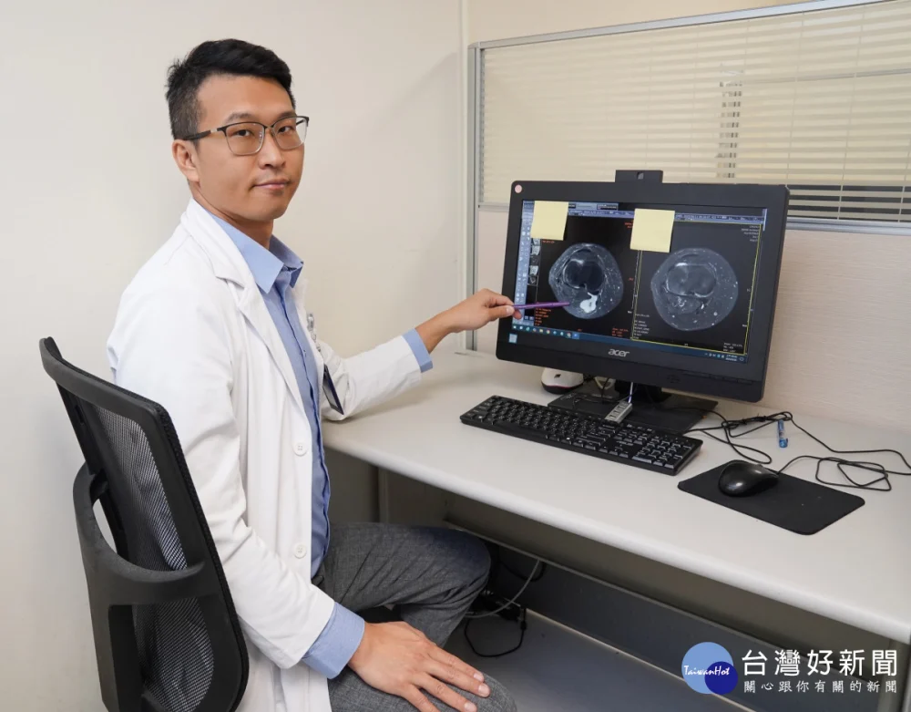 摸到後膝窩有腫塊　醫：貝克氏囊腫作怪