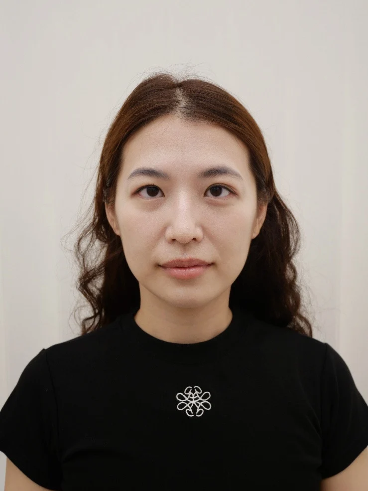 Sandra 療程前臉部狀態紀錄。整體膚況良好，但下半臉輪廓清晰度不足，容易產生疲態印象。