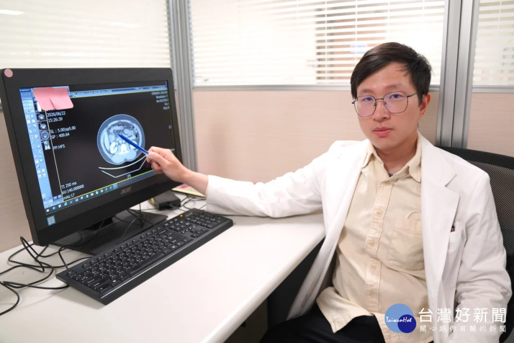 右腹痛急就醫 竟是升結腸憩室炎作祟
