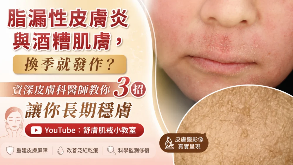 換季膚況拉警報脂漏酒糟反覆纏身　醫師提3招重建皮脂屏障穩膚
